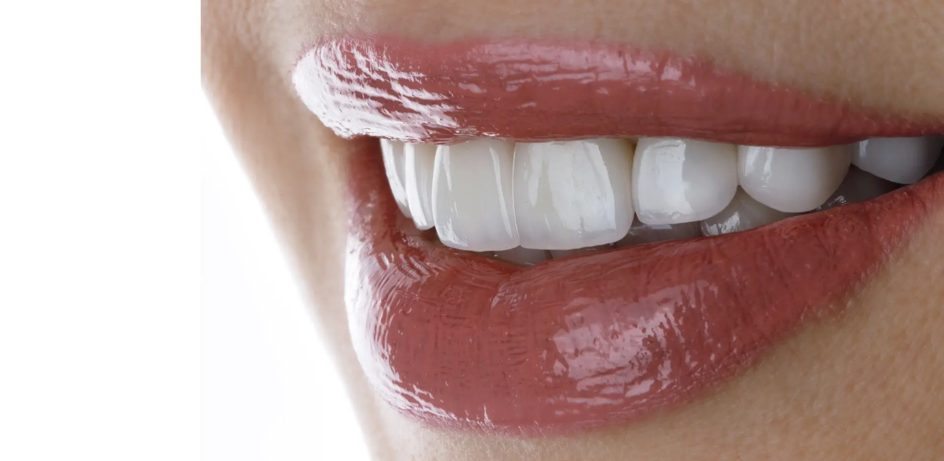 дентална естетика