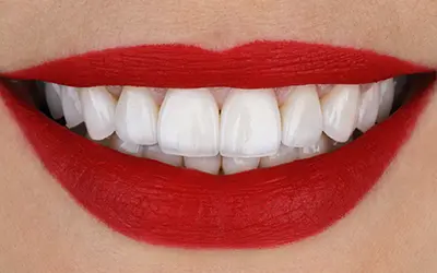 Зъбни коронки и фасети