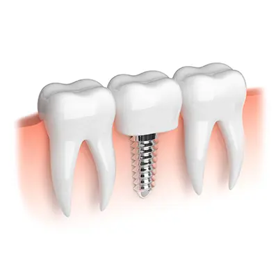 Дентална естетика