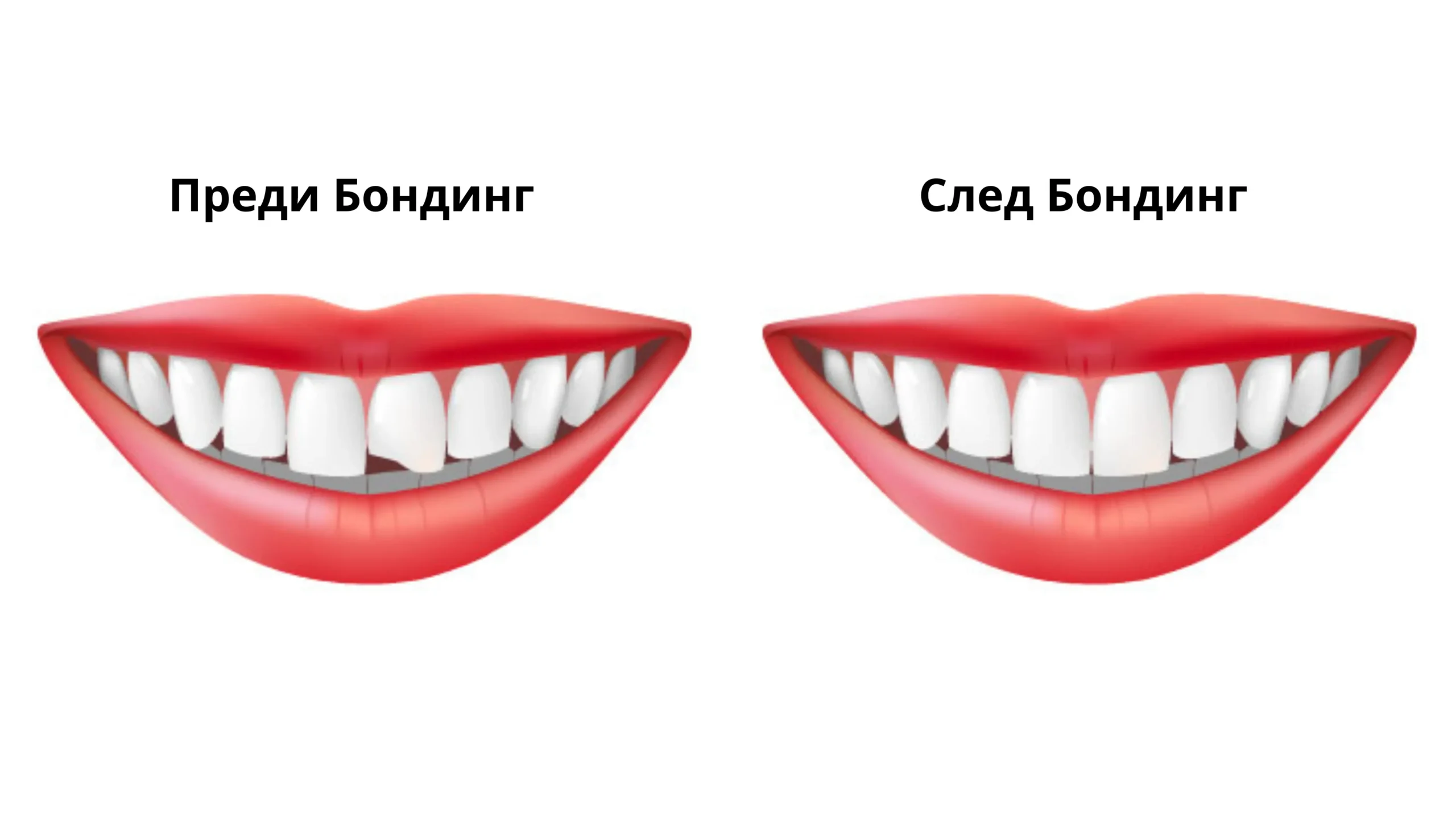 Бондинг