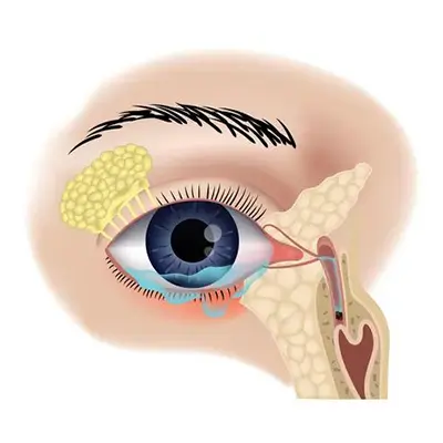 Блефаропластика